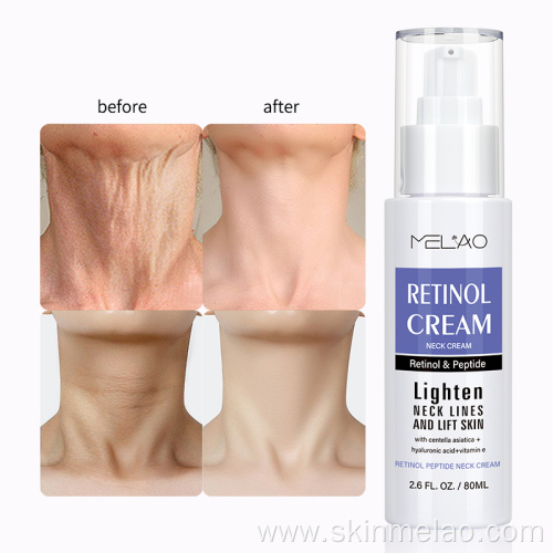 Retinol Polypeptide Skin Anti Aging Neck Cream